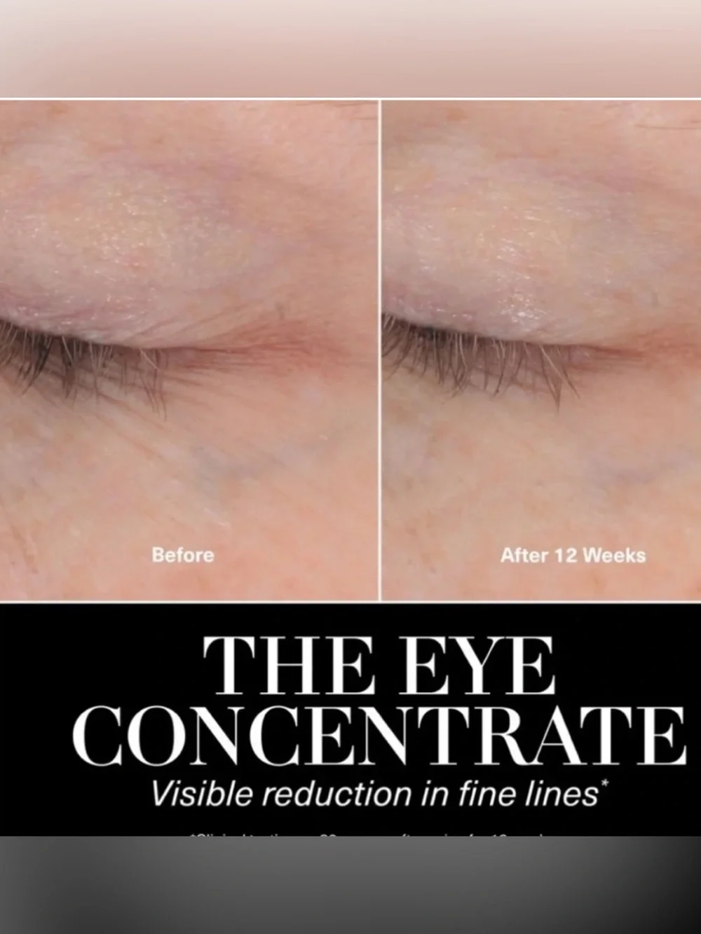 La Mer The Eye Concentrate - 5 Ml